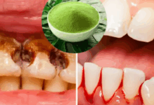 cavity powder
