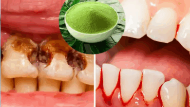 cavity powder
