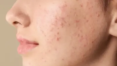 pimple face product