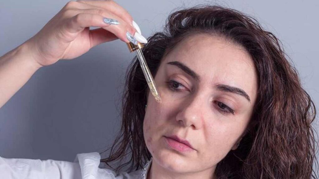 salicylic-acid-for-pimples