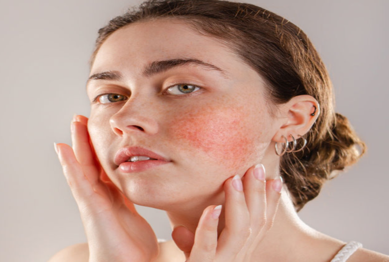 sensitive skin care tips
