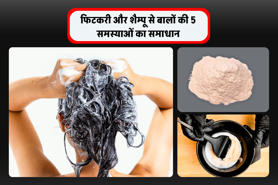 गैस-कब्ज के लिए हार्वर्ड डॉक्टर के 4 असरदार नुस्खे Solve 5 Hair Problems with Alum and Shampoo