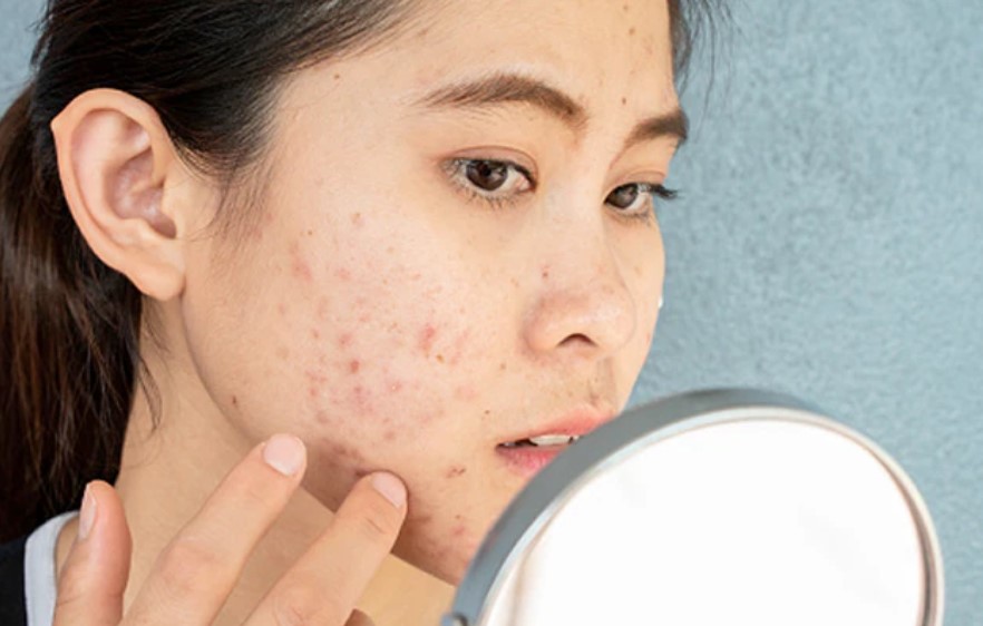 Skin allergy