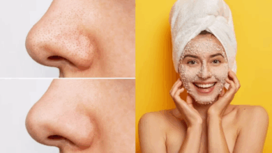 blackheads hatane ke natural tarike
