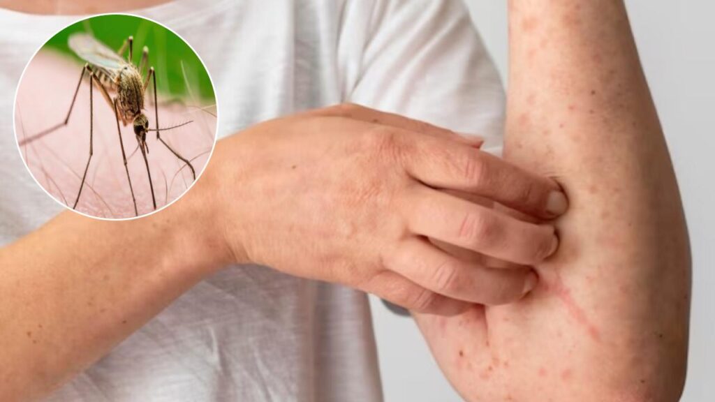 Kuch logo ko jyada mosquitoes kyu katte hai