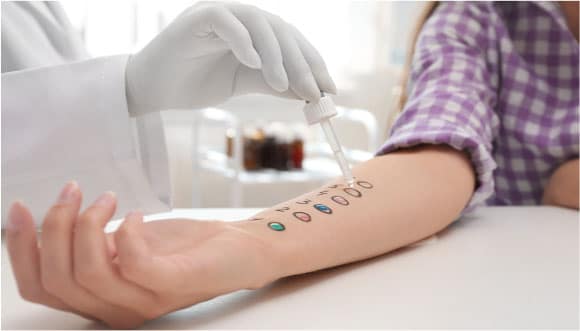Patch test