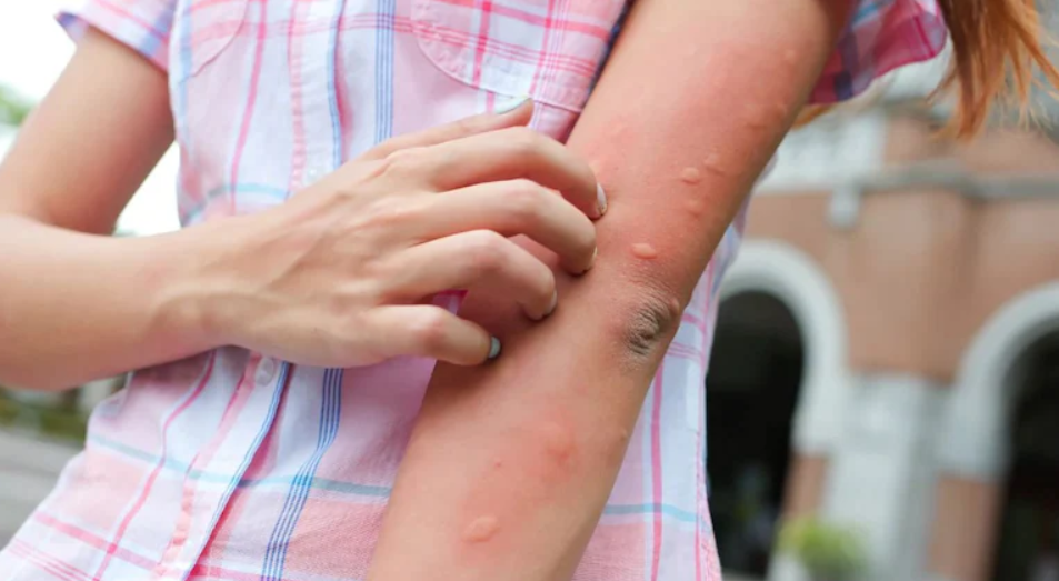 Which Blood Group Attracks Mosquitoes