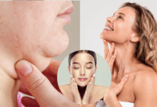 easy exercise to reduce double chin fat
